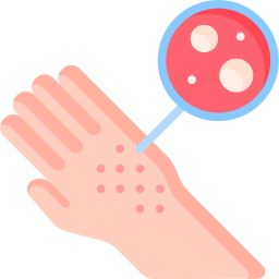 Avatar of Vocabulary Set Penyakit dan Masalah Kulit