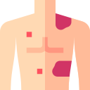 Avatar of Vocabulary Set Penyakit dan Patologi