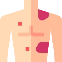 Avatar of Vocabulary Set Penyakit dan Patologi