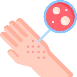 Avatar of Vocabulary Set 皮膚疾病和問題