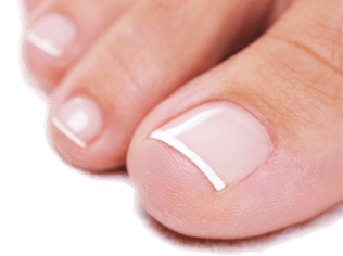 "toenail" picture