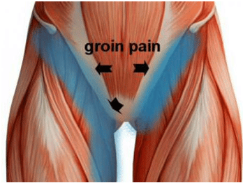 "groin" picture