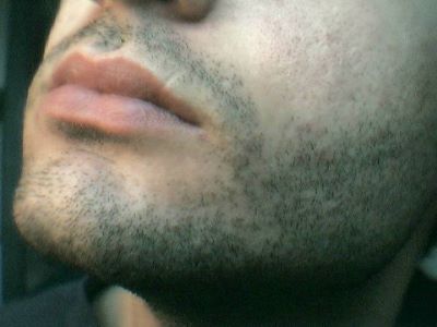"stubble" picture
