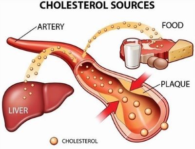 "cholesterol" picture