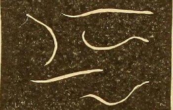 "threadworm" picture