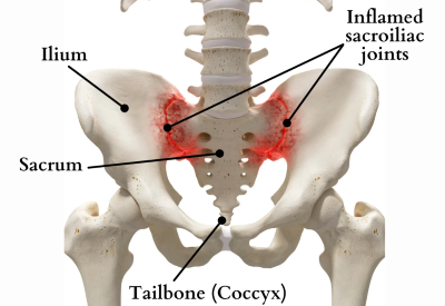 "sacrum" picture