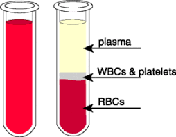 "plasma" picture