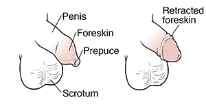 "foreskin" picture