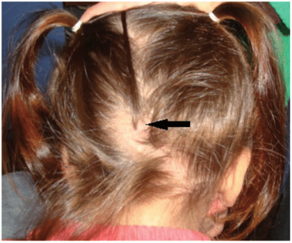 "tuft" picture
