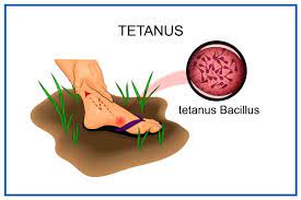 "tetanus" picture