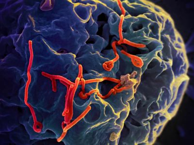 "ebola" picture