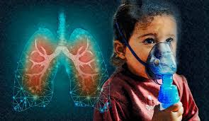 "cystic fibrosis" picture