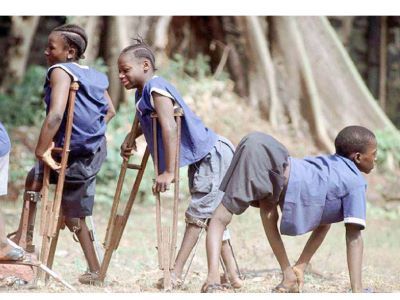 "polio" picture