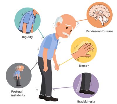 "Parkinson's disease" picture