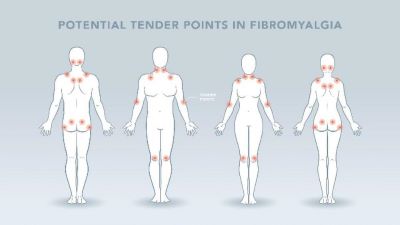 "fibromyalgia" picture