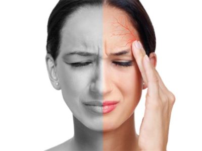 "migraine" picture