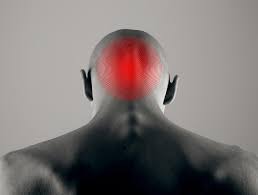 "neuralgia" picture