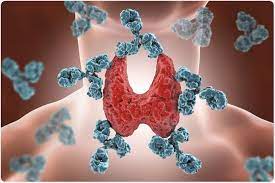 "autoimmune" picture
