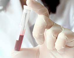 "serology" picture
