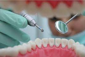 "odontology" picture