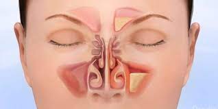 "rhinology" picture