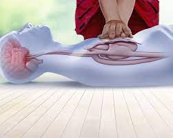 "cpr" picture