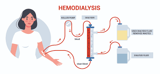 "hemodialysis" picture
