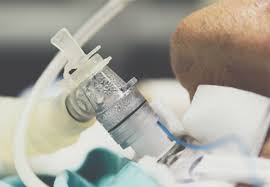 "tracheotomy" picture