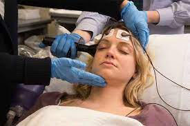 "shock therapy" picture