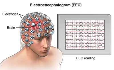 "eeg" picture