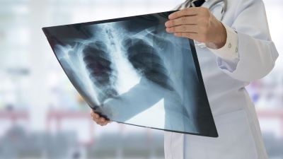 "radiography" picture