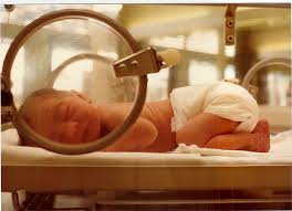 "neonatal" picture