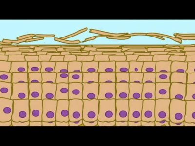 "keratinization" picture