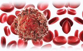 "neoplasia" picture